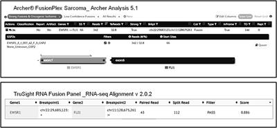 Next-Generation Sequencing Approaches for the Identification of Pathognomonic Fusion Transcripts in Sarcomas: The Experience of the Italian ACC Sarcoma Working Group